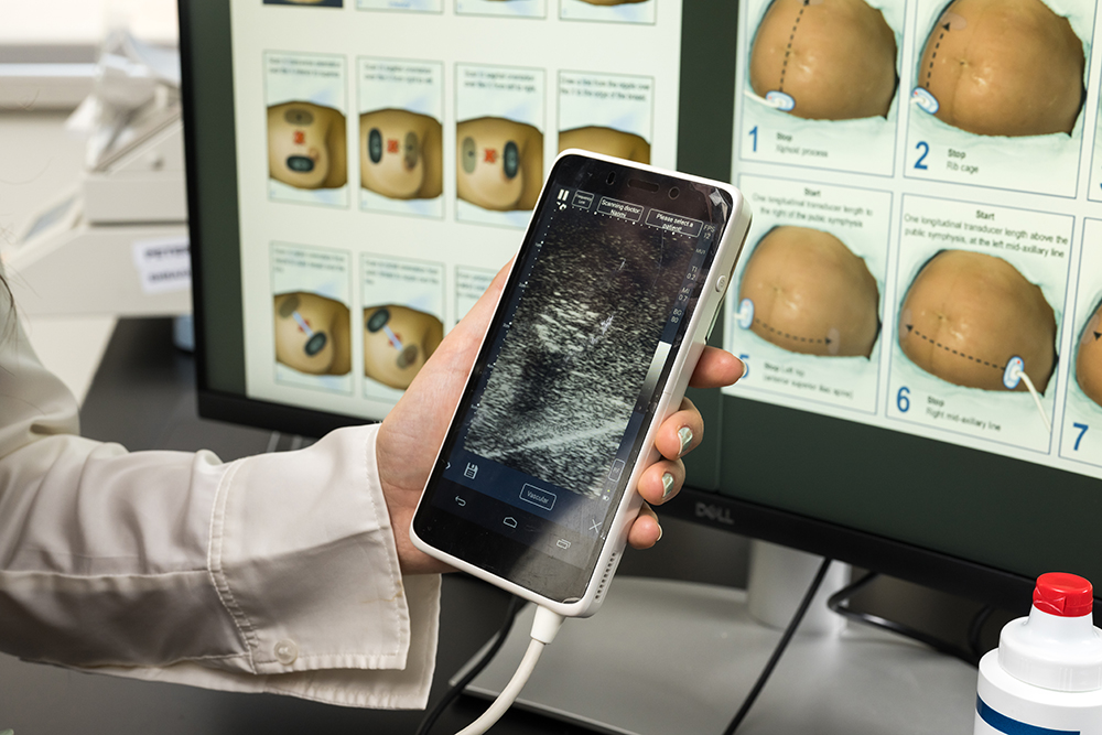 A hand holding a device displaying an ultrasound image.
