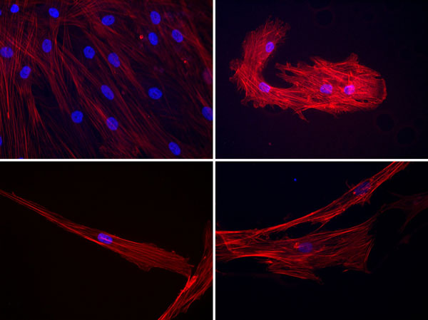 cytoskeleton