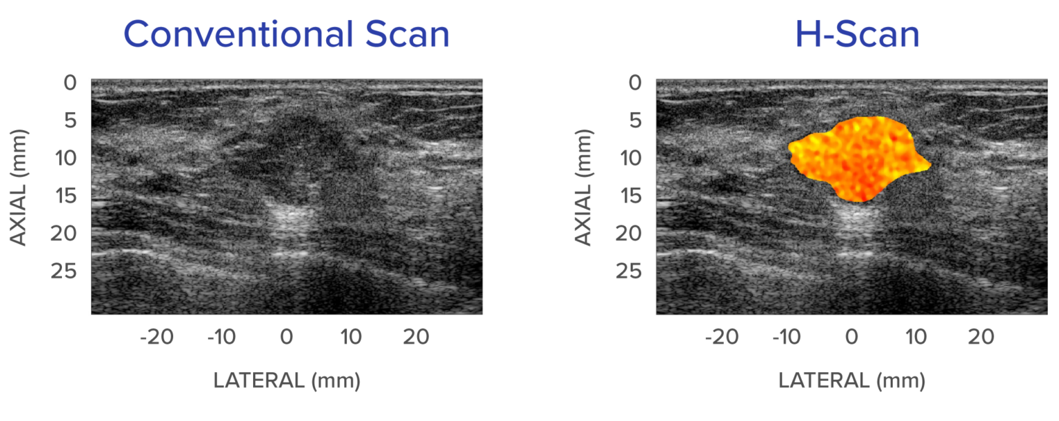 H-scan example